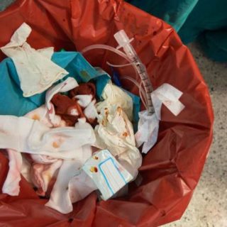 отходы класса в, мешки для медицинских отходов