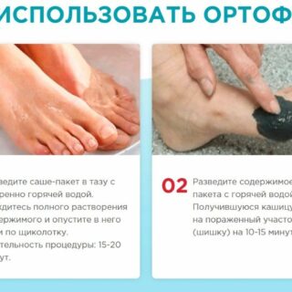 ORTHOFIX Средство от вальгуса